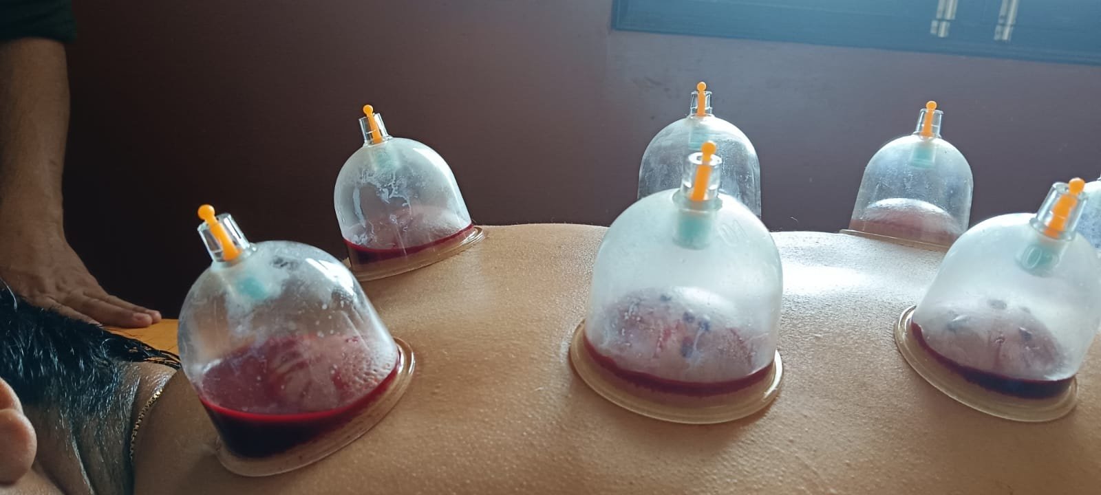 Wellness retreat at Sandhya Hot Spring Healthcare